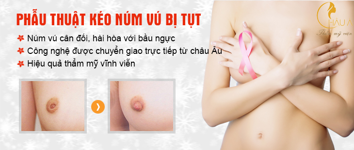 phẫu thuật kéo đầu ngực bị tuột vào trong tại châu á