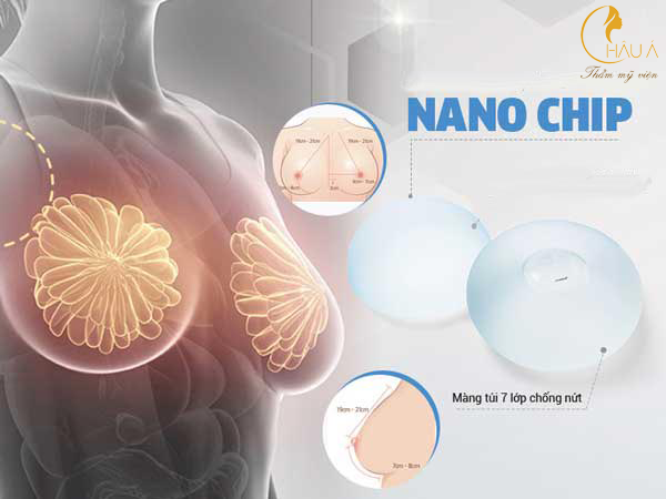 phẫu thuật nâng ngực nano ở đâu hiệu quả