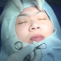 Video phẫu thuật nâng mũi sụn tự thân, bấm mí mắt Hàn Quốc và xử lý sẹo