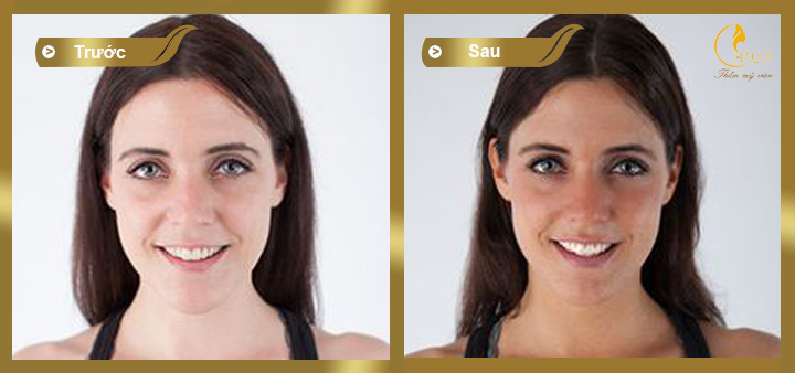 hình ảnh trước và sau khi thực hiện dịch vụ tắm da nâu tại châu á 1